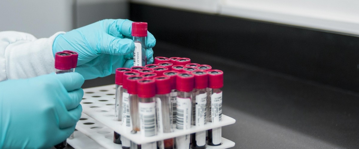 GRENOBLE : Une collecte de sang au Stade des Alpes pour soutenir les patients atteints de cancer